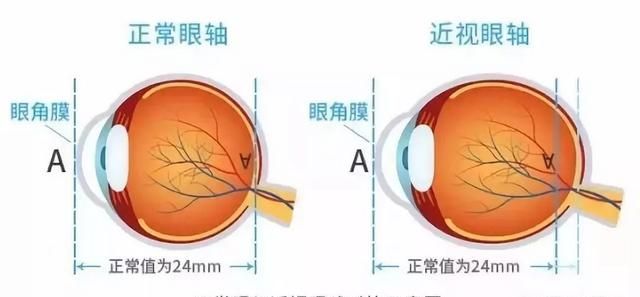 眼镜可以带上飞机吗，五毫升的隐形眼镜护理液可以随身带着上飞机吗？图2