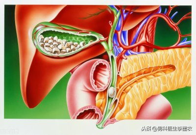 ​尿结石有哪些症状表现呢（尿结石的症状表现及注意事项）