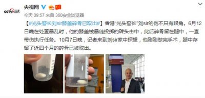 ​香港光头警长刘sir膝盖碎骨已取出，曾被暴徒投掷的砖头击中